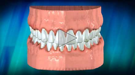 teeth gums image