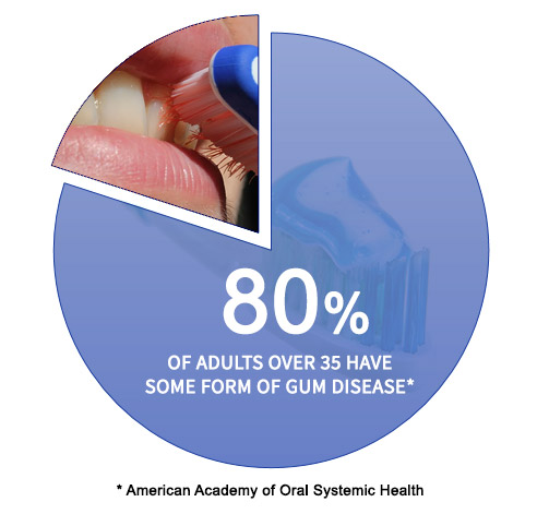 80% of adults over 35 have some form of gum disease